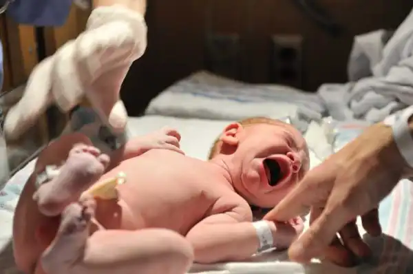 Man Mistakenly Chops Off Baby’s P3nis During Circumcision